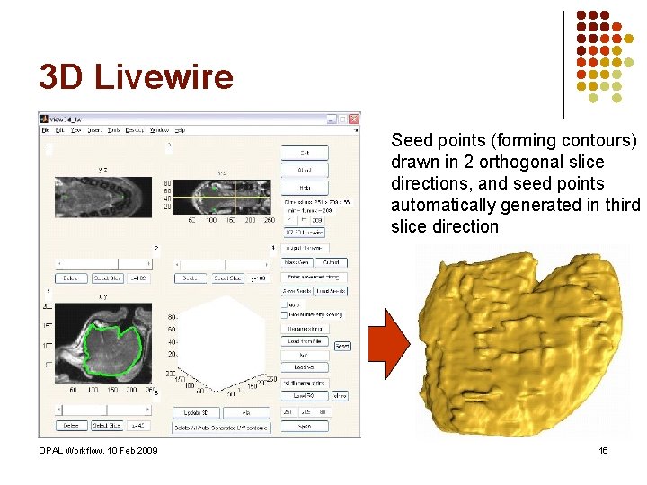 3 D Livewire Seed points (forming contours) drawn in 2 orthogonal slice directions, and