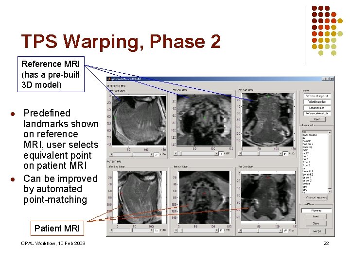 TPS Warping, Phase 2 Reference MRI (has a pre-built 3 D model) l l