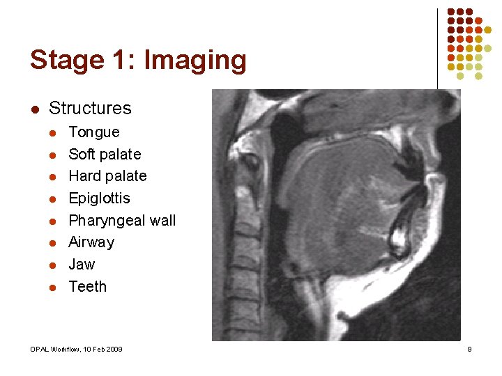 Stage 1: Imaging l Structures l l l l Tongue Soft palate Hard palate