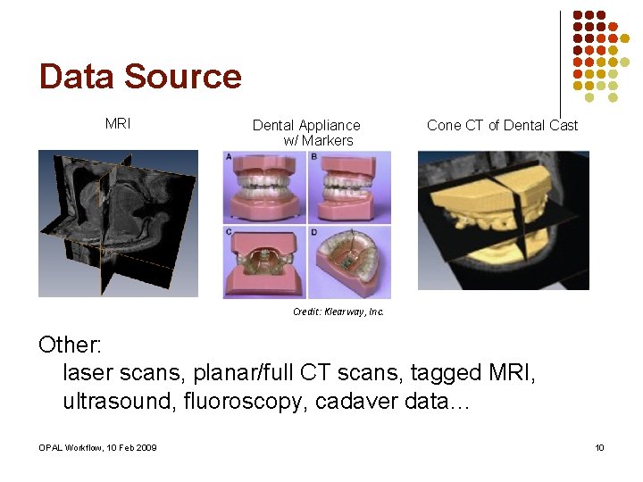 Data Source MRI Dental Appliance w/ Markers Cone CT of Dental Cast Credit: Klearway,