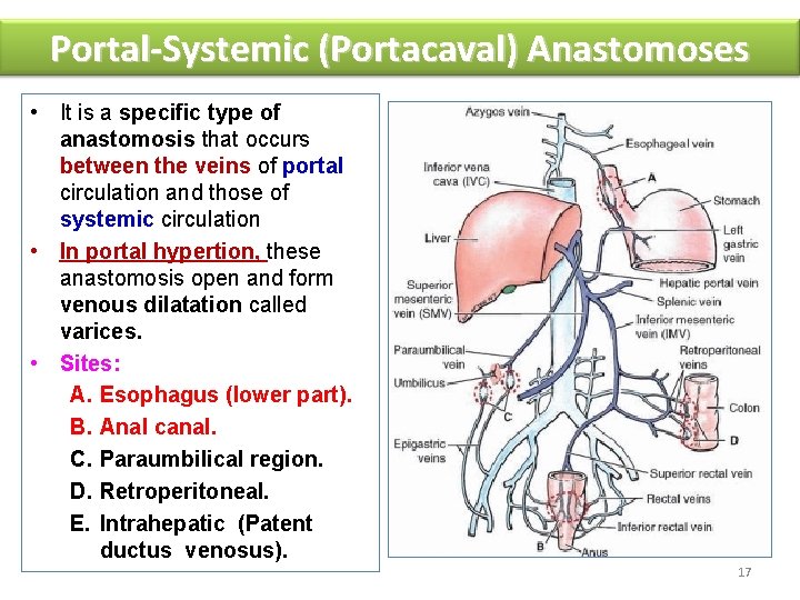 Portal-Systemic (Portacaval) Anastomoses • It is a specific type of anastomosis that occurs between