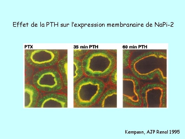Effet de la PTH sur l’expression membranaire de Na. Pi-2 Kempson, AJP Renal 1995