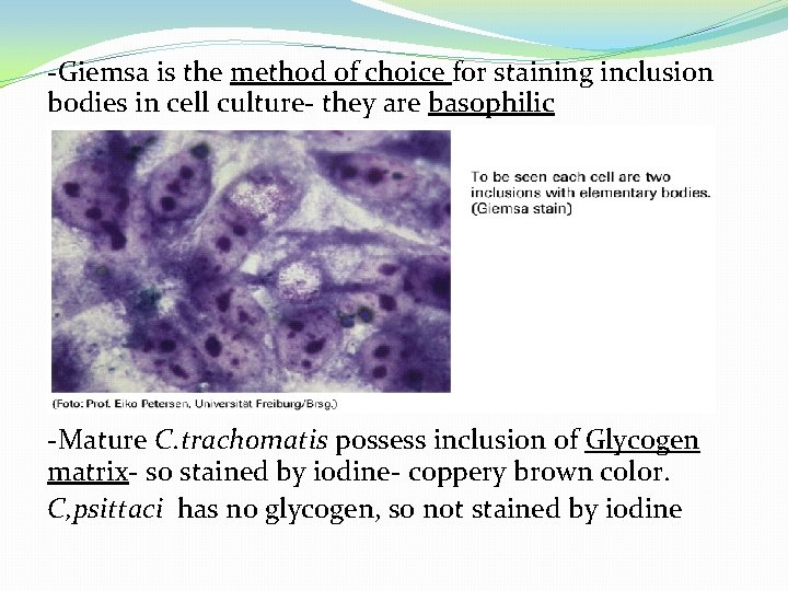 -Giemsa is the method of choice for staining inclusion bodies in cell culture- they