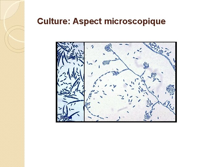 Culture: Aspect microscopique 