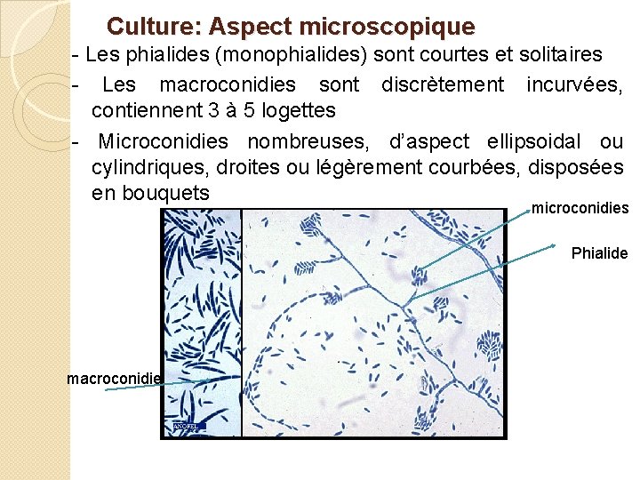 Culture: Aspect microscopique - Les phialides (monophialides) sont courtes et solitaires - Les macroconidies