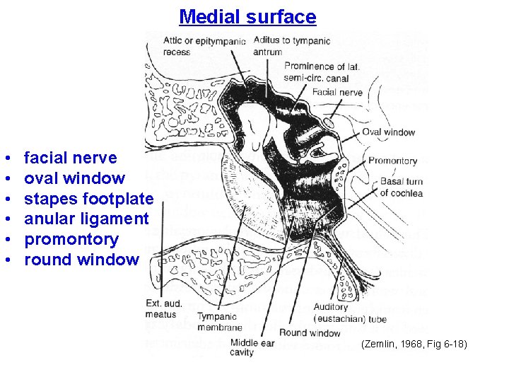 Medial surface • • • facial nerve oval window stapes footplate anular ligament promontory Medial surface • • • facial nerve oval window stapes footplate anular ligament promontory