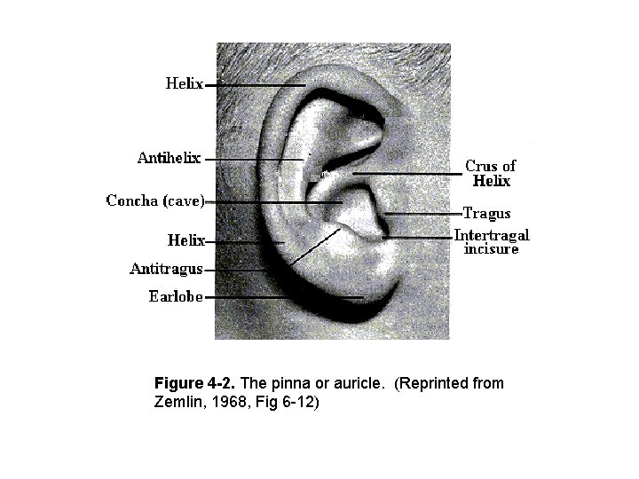 Figure 4 -2. The pinna or auricle. (Reprinted from Zemlin, 1968, Fig 6 -12) Figure 4 -2. The pinna or auricle. (Reprinted from Zemlin, 1968, Fig 6 -12)
