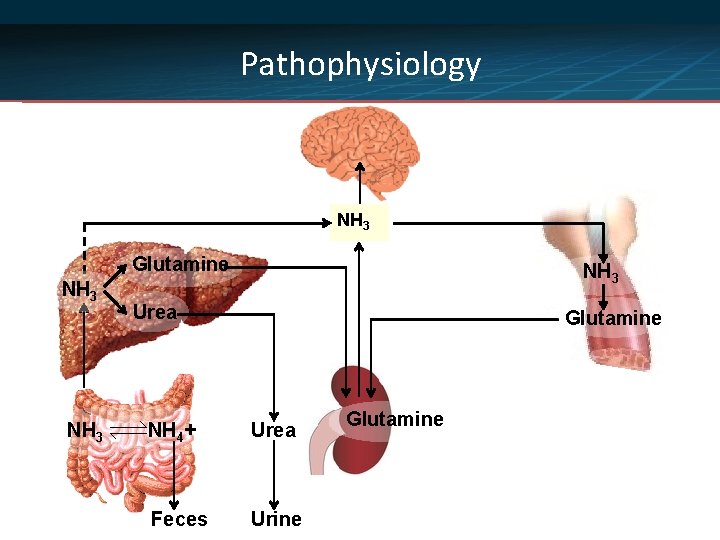 Pathophysiology NH 3 Glutamine NH 3 Urea Glutamine NH 4+ Urea Feces Urine Glutamine
