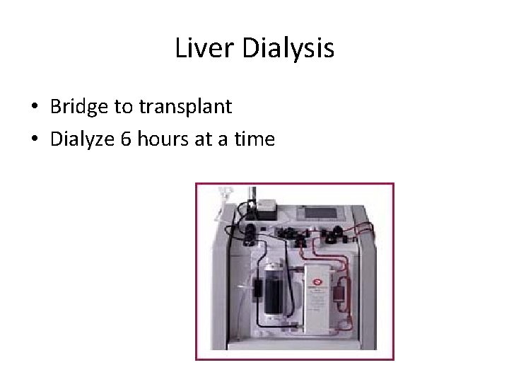 Liver Dialysis • Bridge to transplant • Dialyze 6 hours at a time 