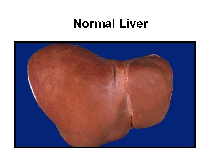 Normal Liver 