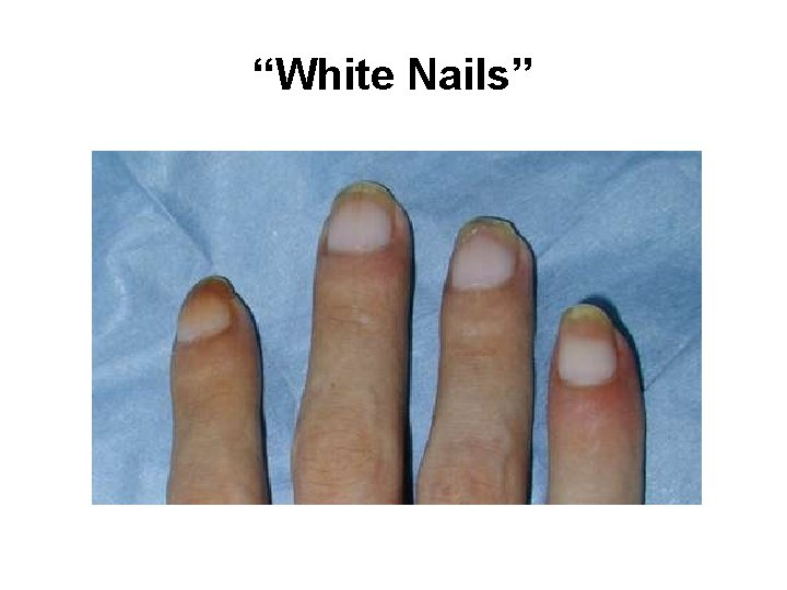 “White Nails” 