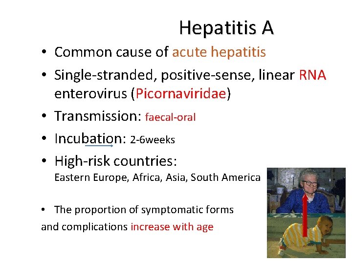 Hepatitis A • Common cause of acute hepatitis • Single-stranded, positive-sense, linear RNA