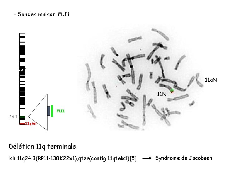 • Sondes maison FLI 1 11 a. N 11 N FLI 1 24. • Sondes maison FLI 1 11 a. N 11 N FLI 1 24.