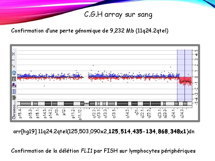 C. G. H array sur sang Confirmation d’une perte génomique de 9, 232 Mb C. G. H array sur sang Confirmation d’une perte génomique de 9, 232 Mb