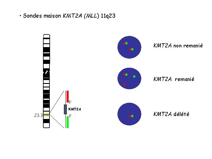 • Sondes maison KMT 2 A (MLL) 11 q 23 KMT 2 A • Sondes maison KMT 2 A (MLL) 11 q 23 KMT 2 A