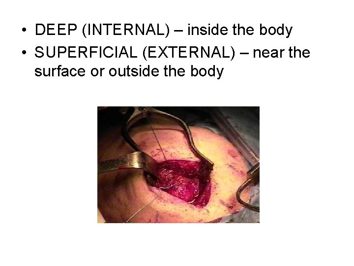  • DEEP (INTERNAL) – inside the body • SUPERFICIAL (EXTERNAL) – near the