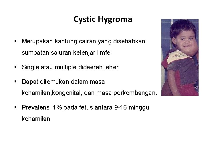 Cystic Hygroma Merupakan kantung cairan yang disebabkan sumbatan saluran kelenjar limfe Single atau multiple Cystic Hygroma Merupakan kantung cairan yang disebabkan sumbatan saluran kelenjar limfe Single atau multiple