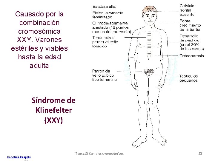 Causado por la combinación cromosómica XXY. Varones estériles y viables hasta la edad adulta Causado por la combinación cromosómica XXY. Varones estériles y viables hasta la edad adulta