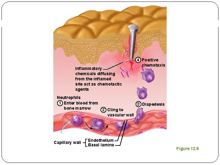 Inflammatory chemicals diffusing from the inflamed site act as chemotactic agents 4 Positive chemotaxis Inflammatory chemicals diffusing from the inflamed site act as chemotactic agents 4 Positive chemotaxis