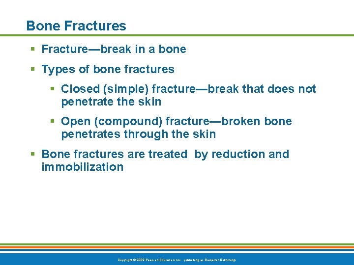 Bone Fractures § Fracture—break in a bone § Types of bone fractures § Closed Bone Fractures § Fracture—break in a bone § Types of bone fractures § Closed