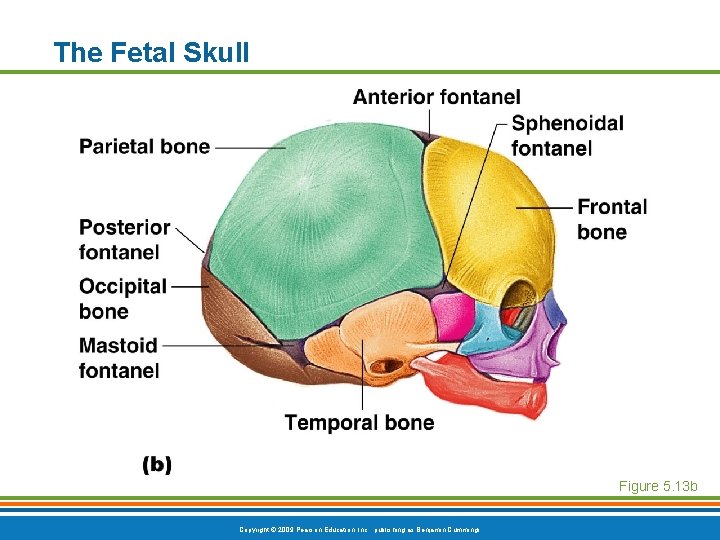 The Fetal Skull Figure 5. 13 b Copyright © 2009 Pearson Education, Inc. , The Fetal Skull Figure 5. 13 b Copyright © 2009 Pearson Education, Inc. ,