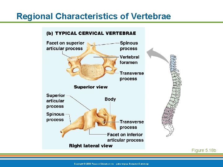 Regional Characteristics of Vertebrae Figure 5. 18 b Copyright © 2009 Pearson Education, Inc. Regional Characteristics of Vertebrae Figure 5. 18 b Copyright © 2009 Pearson Education, Inc.