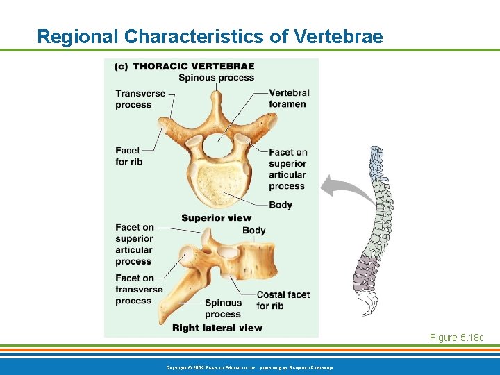 Regional Characteristics of Vertebrae Figure 5. 18 c Copyright © 2009 Pearson Education, Inc. Regional Characteristics of Vertebrae Figure 5. 18 c Copyright © 2009 Pearson Education, Inc.