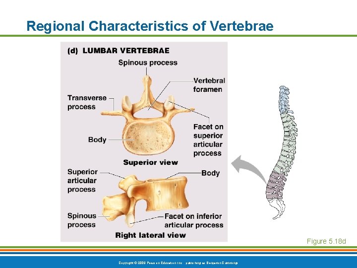 Regional Characteristics of Vertebrae Figure 5. 18 d Copyright © 2009 Pearson Education, Inc. Regional Characteristics of Vertebrae Figure 5. 18 d Copyright © 2009 Pearson Education, Inc.