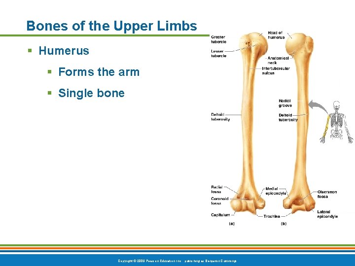 Bones of the Upper Limbs § Humerus § Forms the arm § Single bone Bones of the Upper Limbs § Humerus § Forms the arm § Single bone