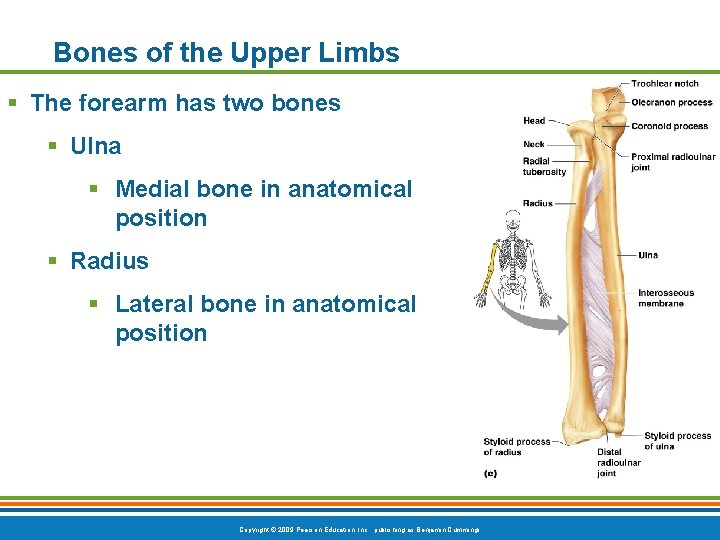 Bones of the Upper Limbs § The forearm has two bones § Ulna § Bones of the Upper Limbs § The forearm has two bones § Ulna §
