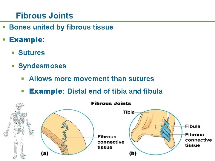 Fibrous Joints § Bones united by fibrous tissue § Example: § Sutures § Syndesmoses Fibrous Joints § Bones united by fibrous tissue § Example: § Sutures § Syndesmoses