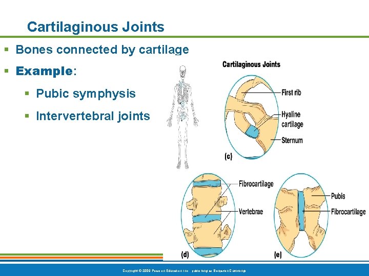 Cartilaginous Joints § Bones connected by cartilage § Example: § Pubic symphysis § Intervertebral Cartilaginous Joints § Bones connected by cartilage § Example: § Pubic symphysis § Intervertebral
