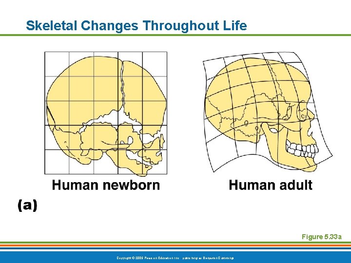 Skeletal Changes Throughout Life Figure 5. 33 a Copyright © 2009 Pearson Education, Inc. Skeletal Changes Throughout Life Figure 5. 33 a Copyright © 2009 Pearson Education, Inc.