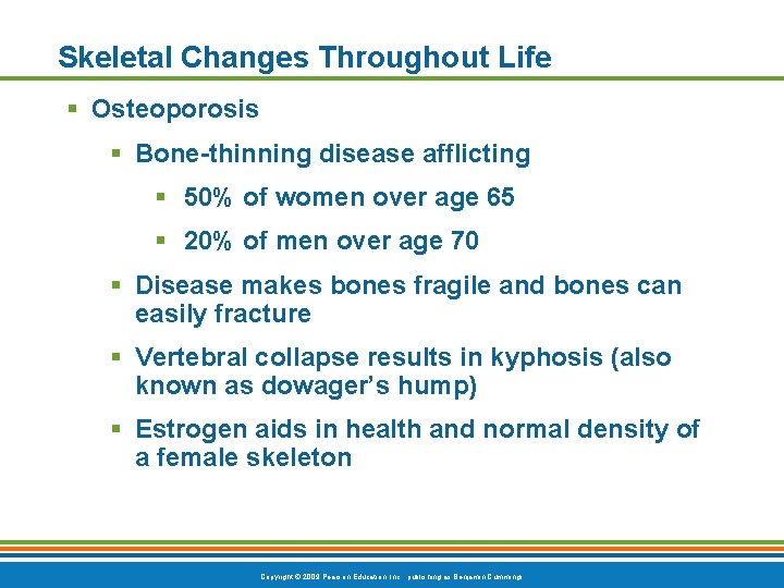 Skeletal Changes Throughout Life § Osteoporosis § Bone-thinning disease afflicting § 50% of women Skeletal Changes Throughout Life § Osteoporosis § Bone-thinning disease afflicting § 50% of women