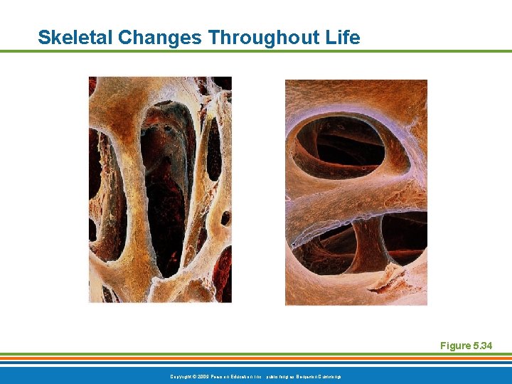 Skeletal Changes Throughout Life Figure 5. 34 Copyright © 2009 Pearson Education, Inc. , Skeletal Changes Throughout Life Figure 5. 34 Copyright © 2009 Pearson Education, Inc. ,
