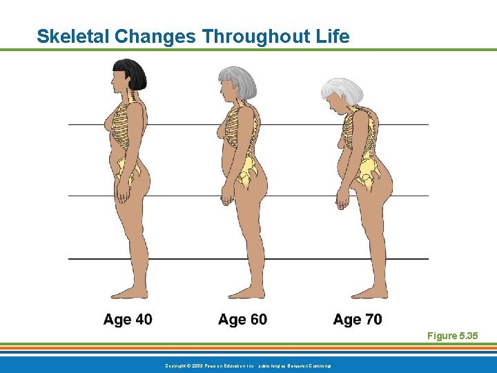 Skeletal Changes Throughout Life Figure 5. 35 Copyright © 2009 Pearson Education, Inc. , Skeletal Changes Throughout Life Figure 5. 35 Copyright © 2009 Pearson Education, Inc. ,