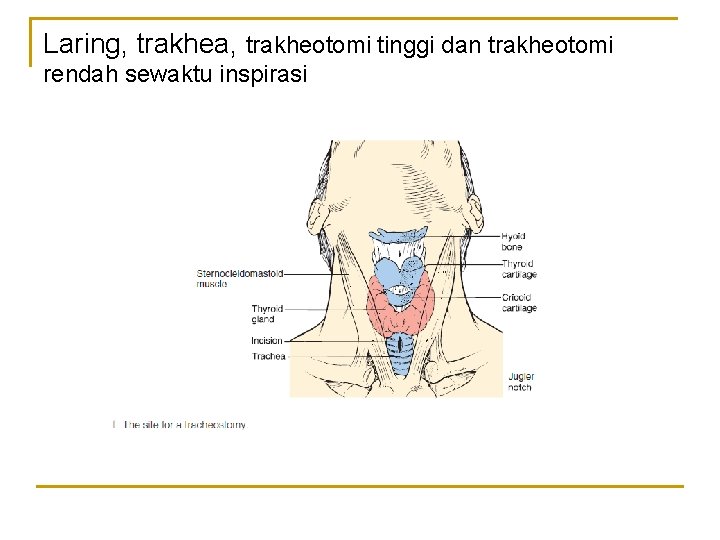 Laring, trakhea, trakheotomi tinggi dan trakheotomi rendah sewaktu inspirasi Laring, trakhea, trakheotomi tinggi dan trakheotomi rendah sewaktu inspirasi
