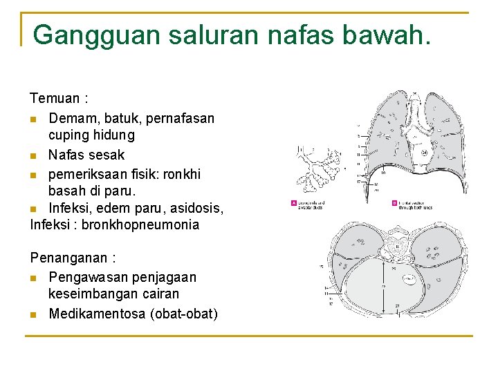 Gangguan saluran nafas bawah. Temuan : n Demam, batuk, pernafasan cuping hidung n Nafas Gangguan saluran nafas bawah. Temuan : n Demam, batuk, pernafasan cuping hidung n Nafas