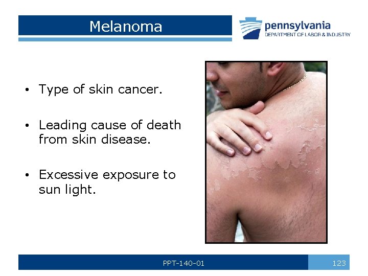 Melanoma • Type of skin cancer. • Leading cause of death from skin disease.