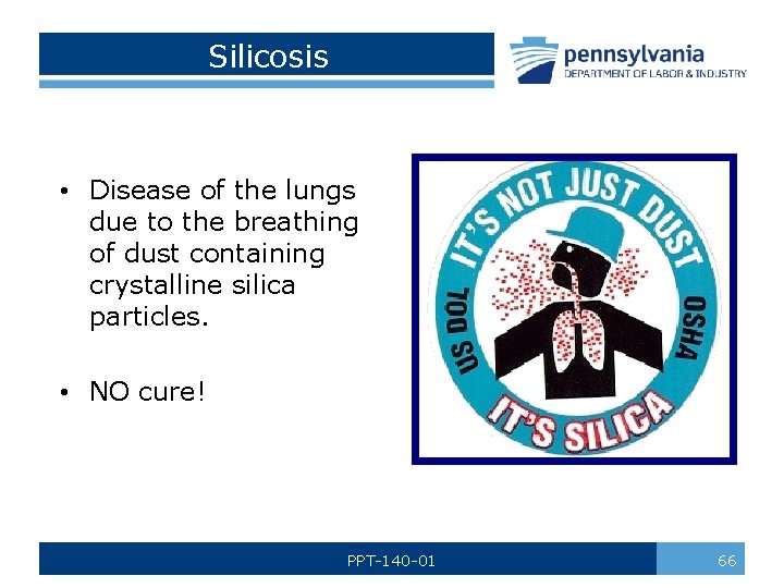 Silicosis • Disease of the lungs due to the breathing of dust containing crystalline
