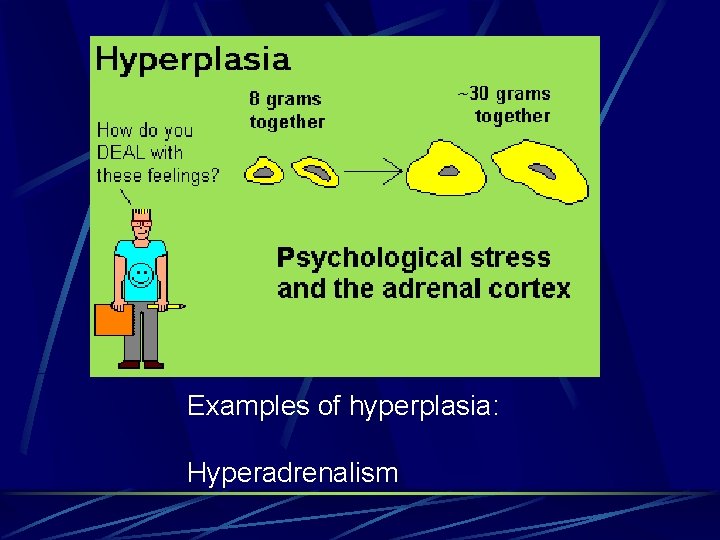 Examples of hyperplasia: Hyperadrenalism 