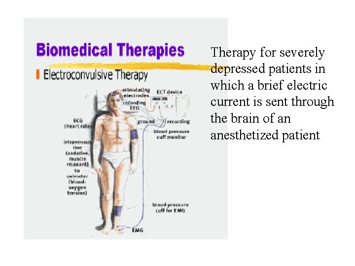 Therapy for severely depressed patients in which a brief electric current is sent through