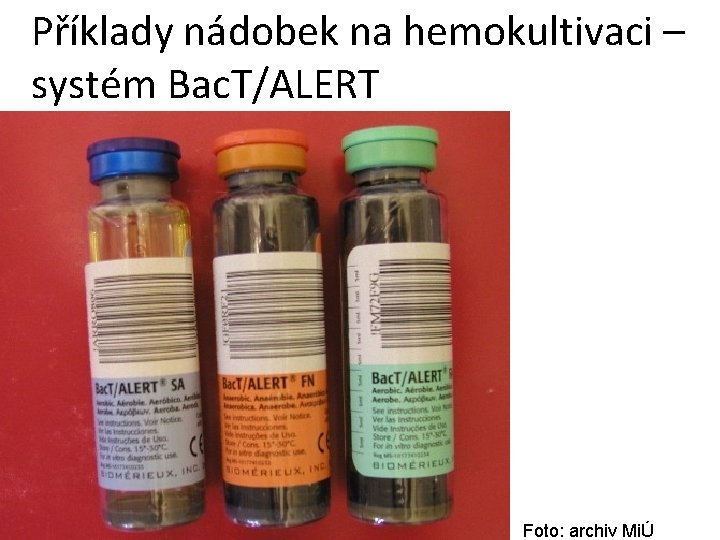 Příklady nádobek na hemokultivaci – systém Bac. T/ALERT Foto: archiv MiÚ Příklady nádobek na hemokultivaci – systém Bac. T/ALERT Foto: archiv MiÚ