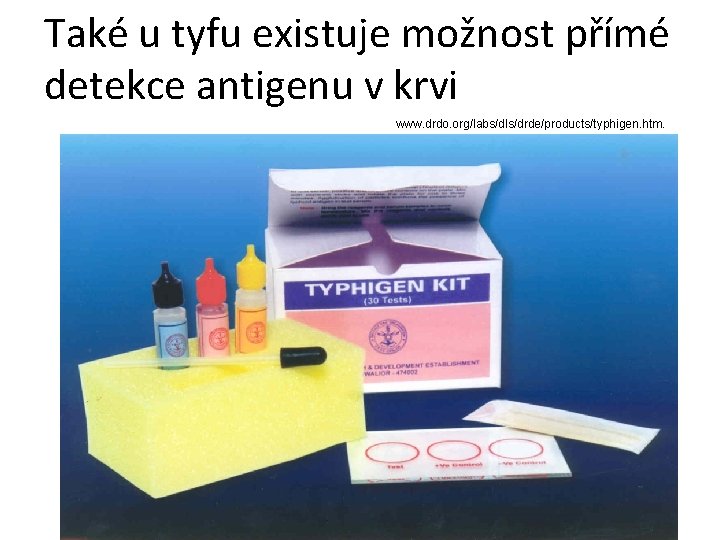 Také u tyfu existuje možnost přímé detekce antigenu v krvi www. drdo. org/labs/dls/drde/products/typhigen. htm. Také u tyfu existuje možnost přímé detekce antigenu v krvi www. drdo. org/labs/dls/drde/products/typhigen. htm.