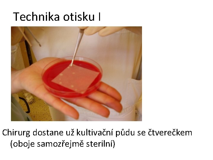 Technika otisku I Chirurg dostane už kultivační půdu se čtverečkem (oboje samozřejmě sterilní) Technika otisku I Chirurg dostane už kultivační půdu se čtverečkem (oboje samozřejmě sterilní)