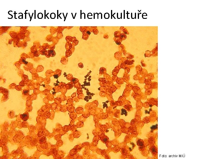 Stafylokoky v hemokultuře Foto: archiv MiÚ Stafylokoky v hemokultuře Foto: archiv MiÚ