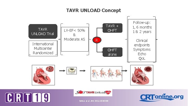 TAVR UNLOAD Concept TAVR UNLOAD Trial International Multicenter Randomized LV-EF< 50% & Moderate AS TAVR UNLOAD Concept TAVR UNLOAD Trial International Multicenter Randomized LV-EF< 50% & Moderate AS