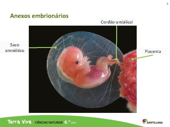 9 Anexos embrionários Saco amniótico Cordão umbilical Placenta 9 Anexos embrionários Saco amniótico Cordão umbilical Placenta