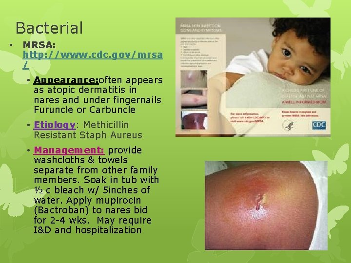 Bacterial • MRSA: http: //www. cdc. gov/mrsa / • Appearance: often appears as atopic