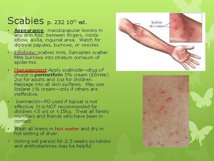 Scabies p. 232 10 th ed. • Appearance: maculopapular lesions in any skin fold: